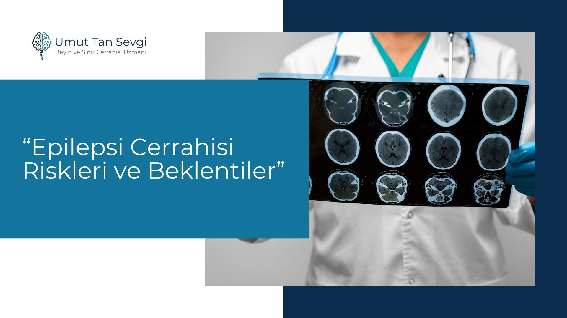 Epilepsi Cerrahisi Riskleri ve Beklentiler