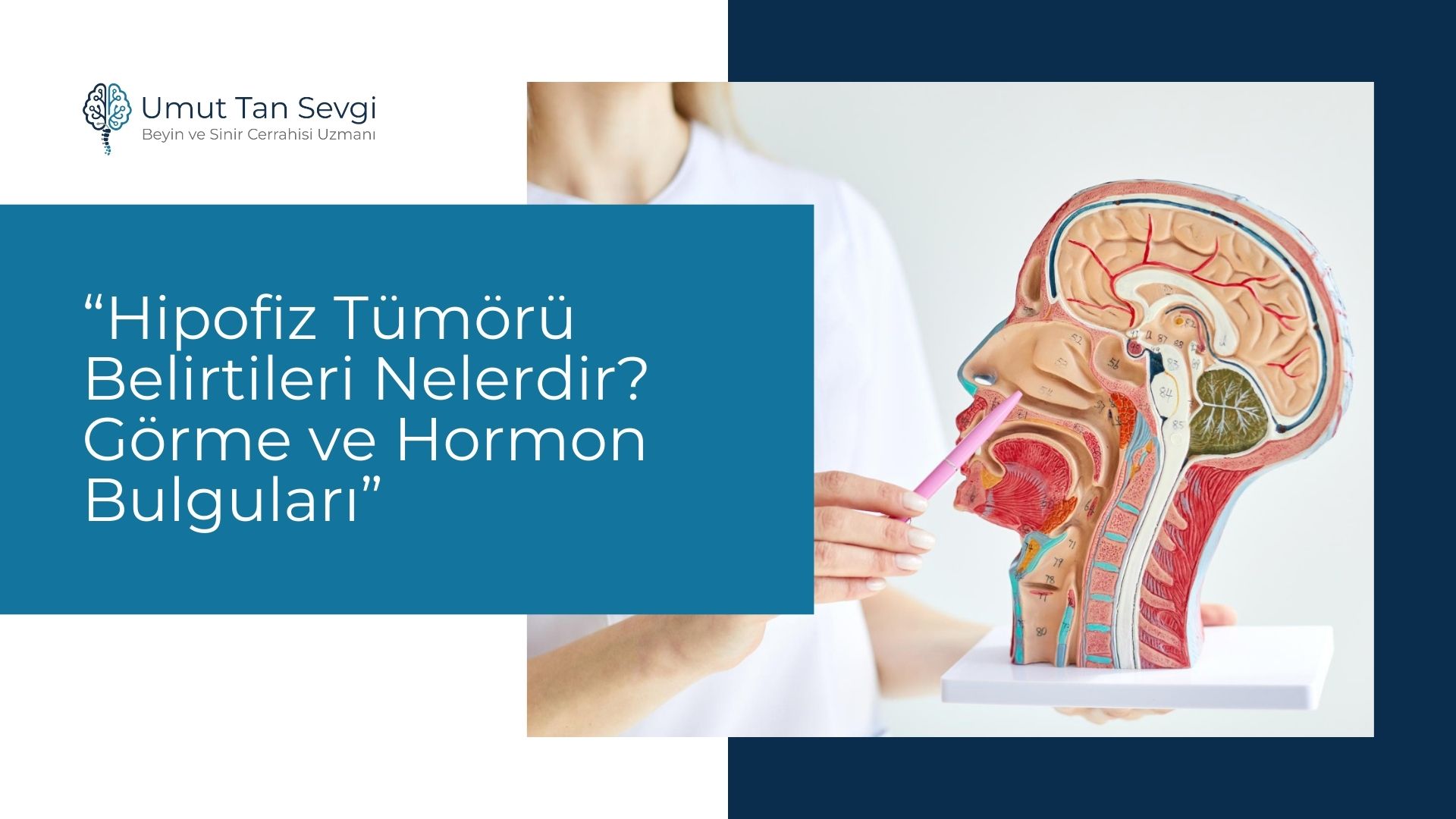Hipofiz Tümörü Belirtileri Nelerdir? Görme ve Hormon Bulguları