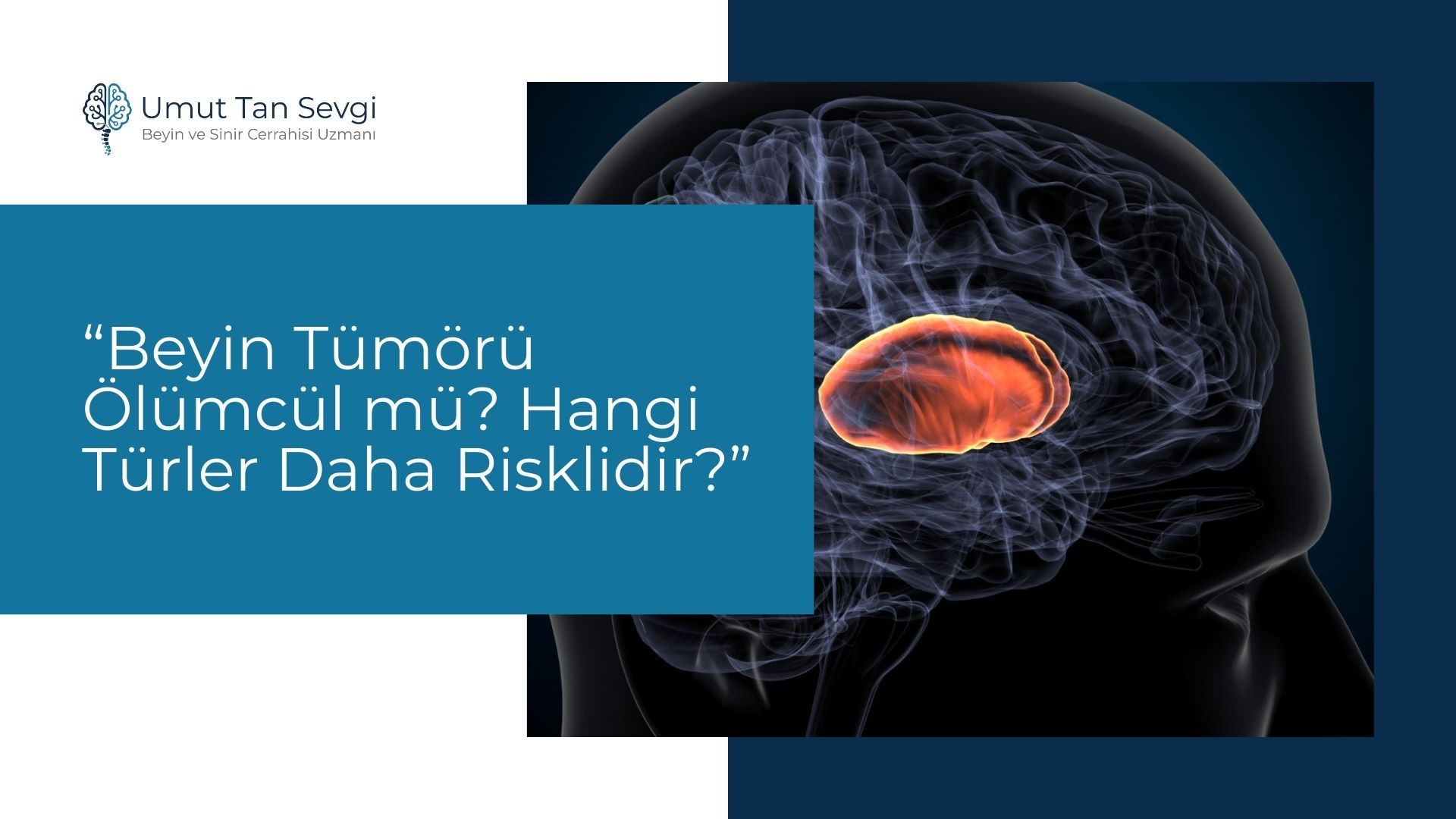 Beyin Tümörü Ölümcül mü? Hangi Türler Daha Risklidir?