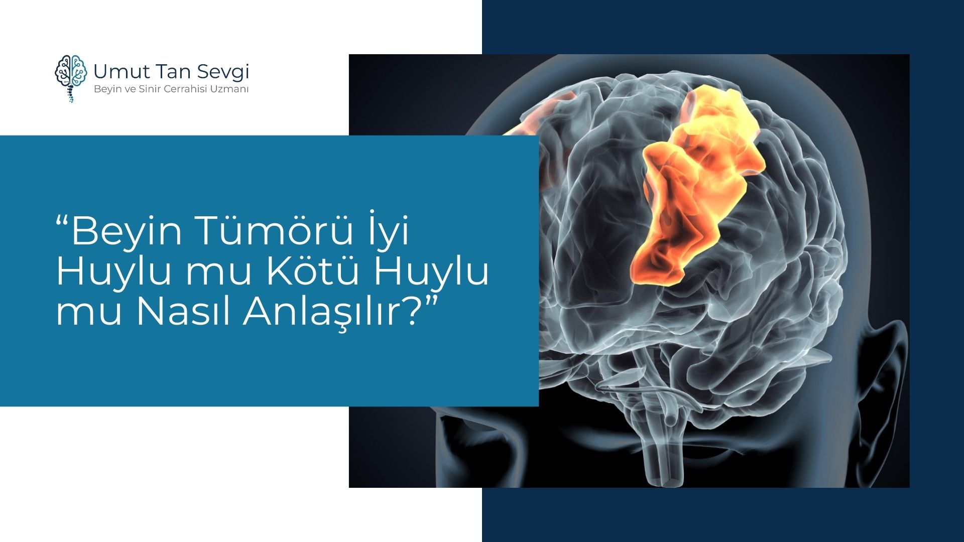 Beyin Tümörü İyi Huylu mu Kötü Huylu mu Nasıl Anlaşılır?