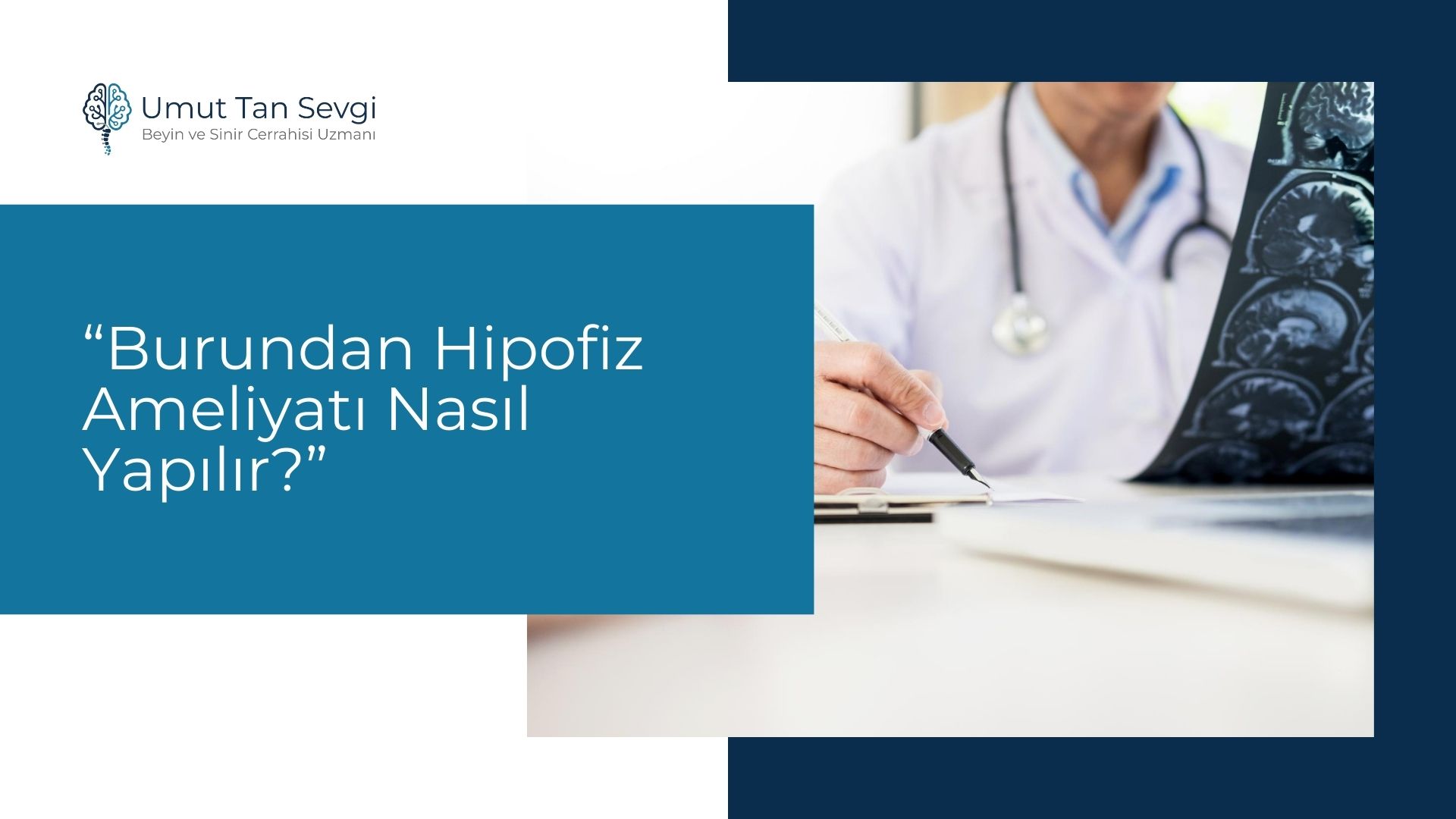 Burundan Hipofiz Ameliyatı Nasıl Yapılır?