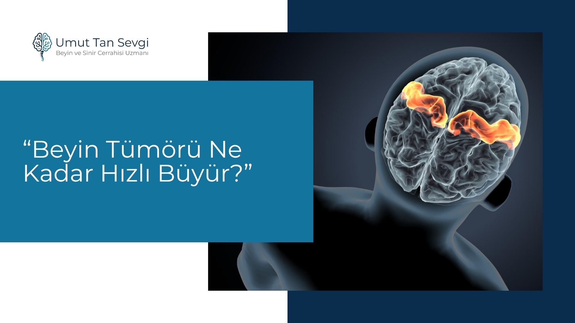 Beyin Tümörü Ne Kadar Hızlı Büyür?