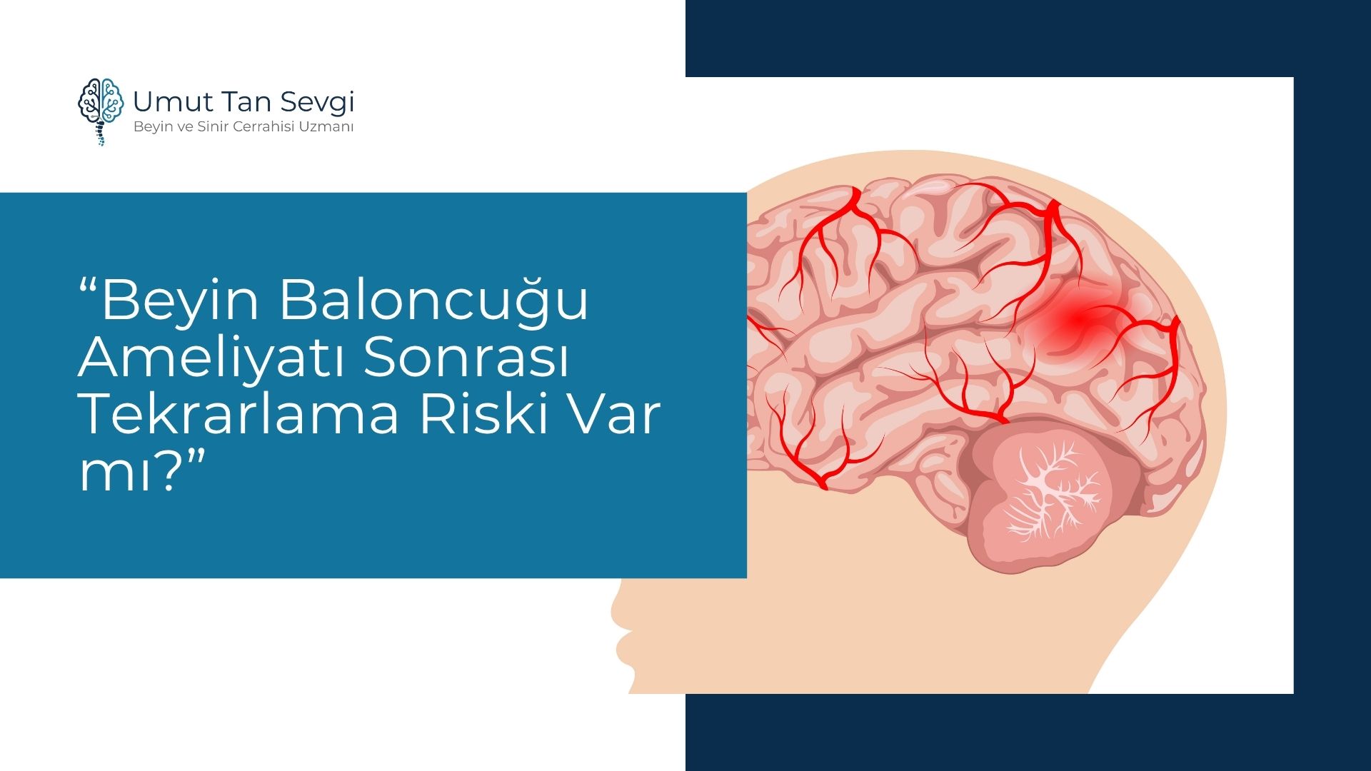 Beyin Baloncuğu Ameliyatı Sonrası Tekrarlama Riski Var mı?