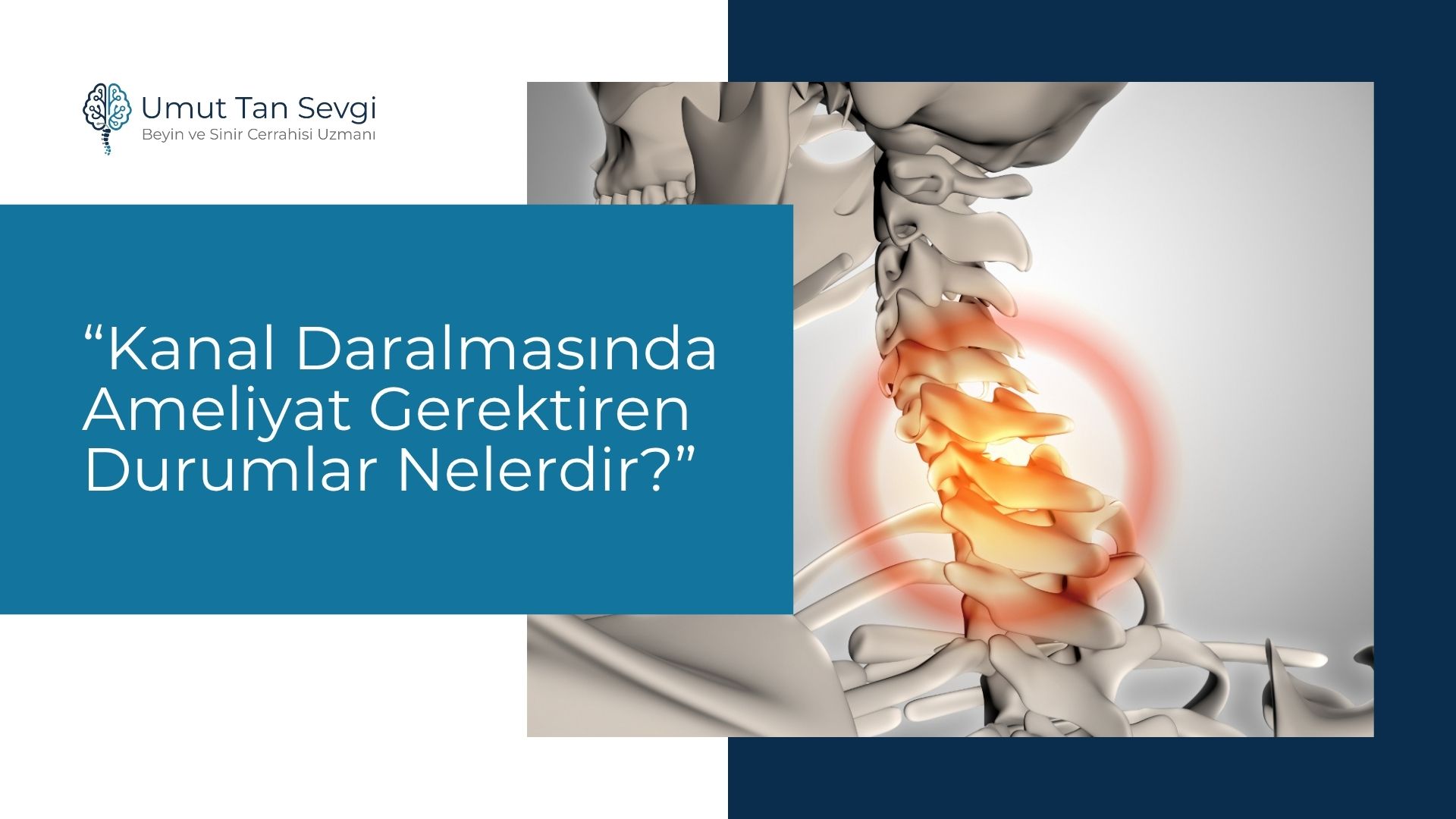 Kanal Daralmasında Ameliyat Gerektiren Durumlar Nelerdir?