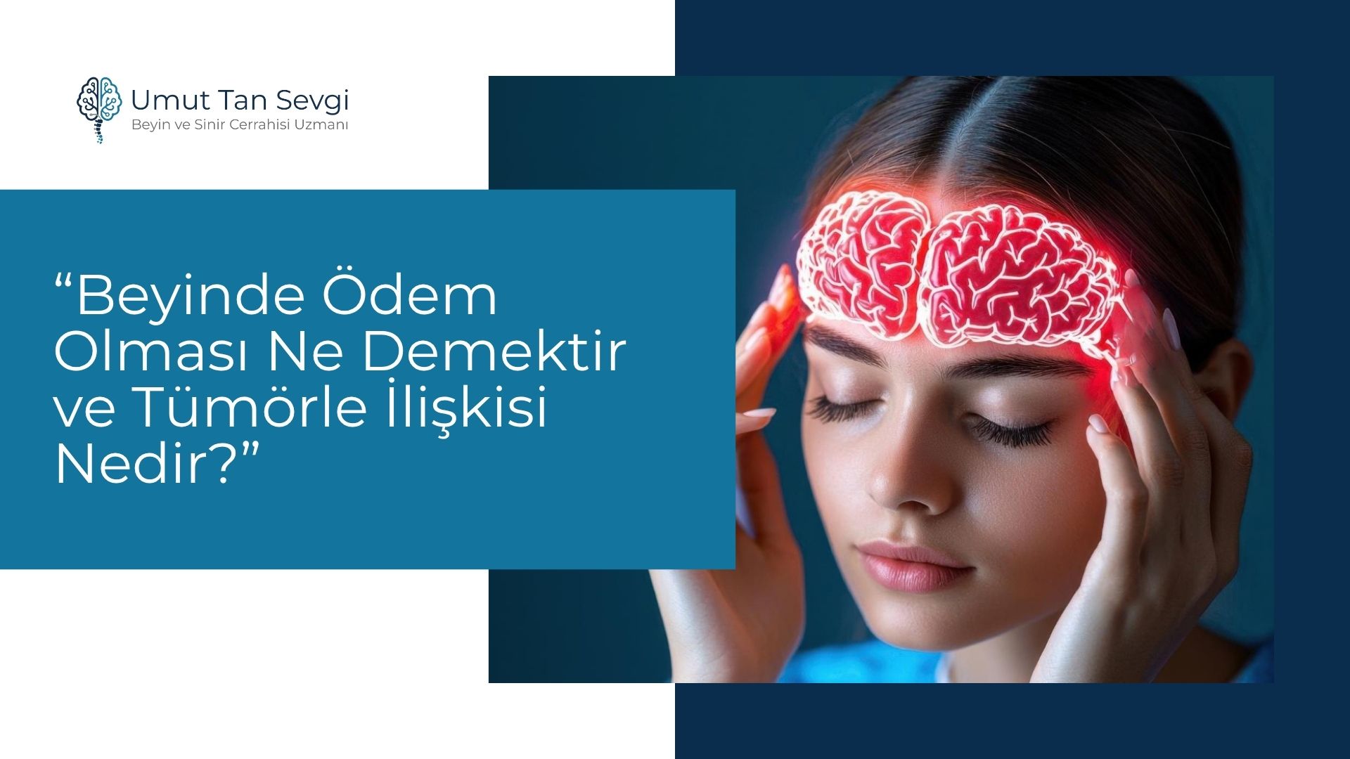 Beyinde Ödem Olması Ne Demektir ve Tümörle İlişkisi Nedir?