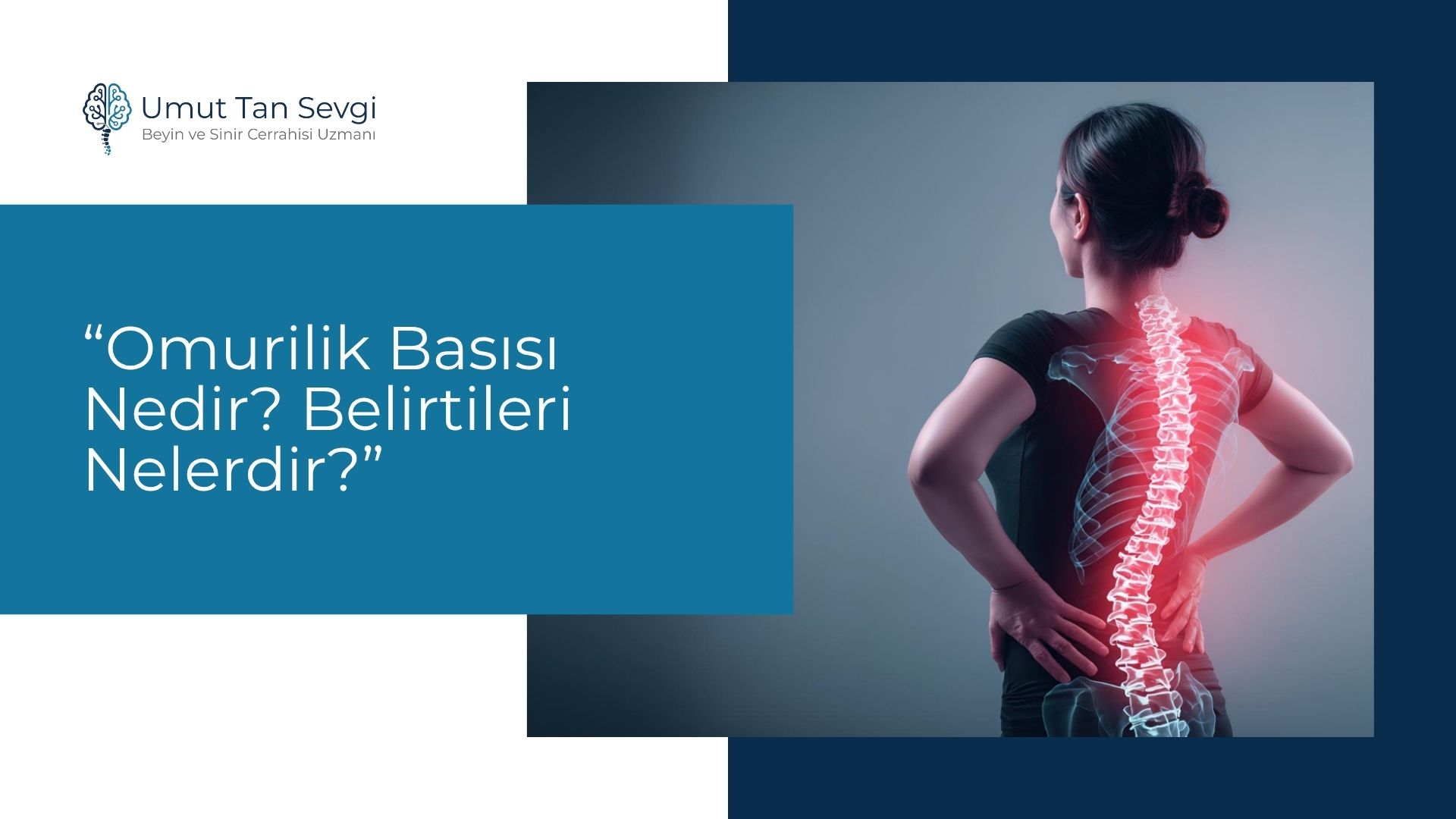 Omurilik Basısı Nedir? Belirtileri Nelerdir?