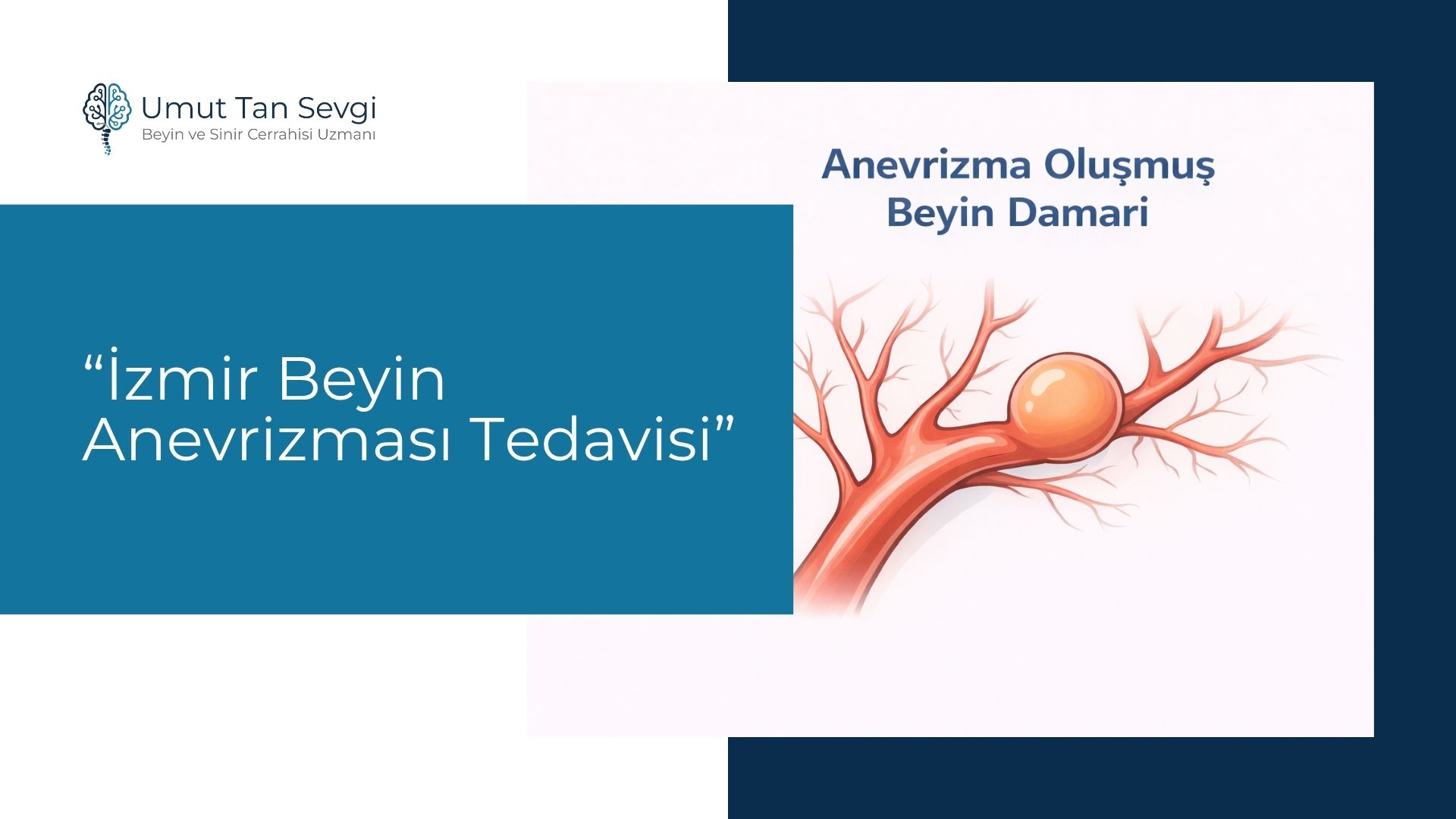 İzmir Beyin Anevrizması Tedavisi