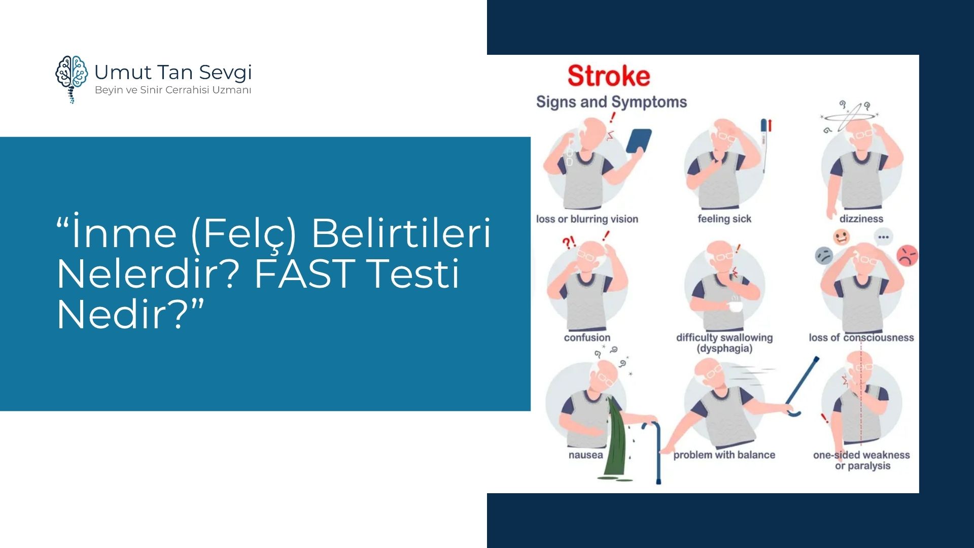 İnme (Felç) Belirtileri Nelerdir? FAST Testi Nedir?