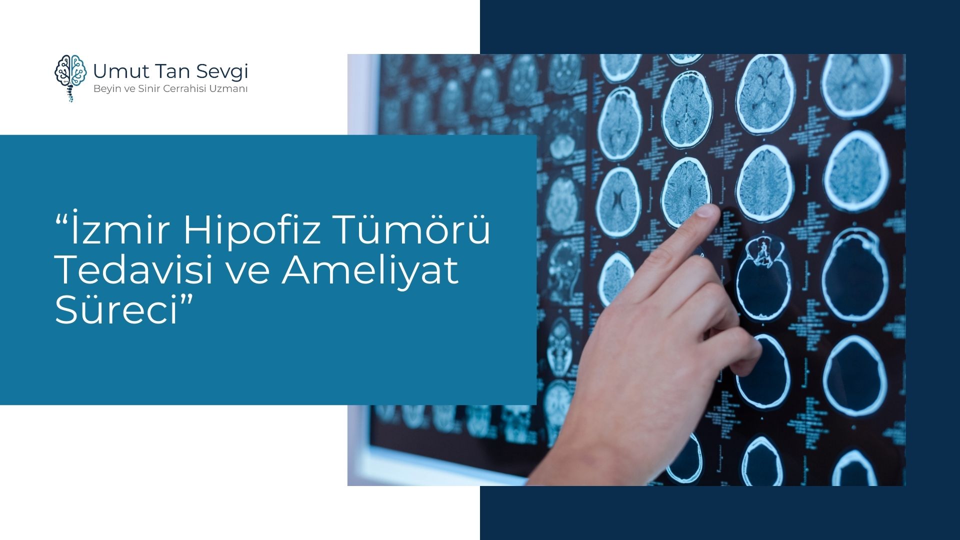 İzmir Hipofiz Tümörü Tedavisi ve Ameliyat Süreci