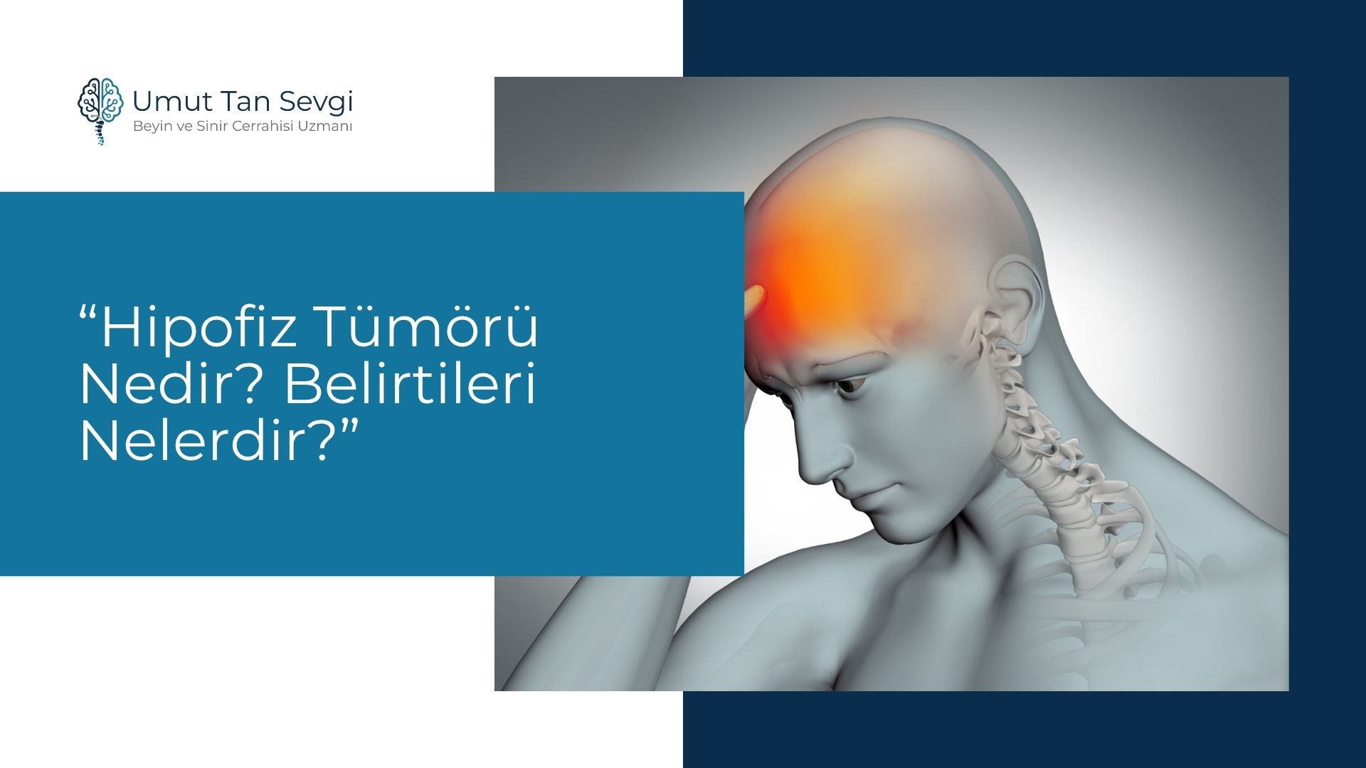 Hipofiz Tümörü Nedir? Belirtileri Nelerdir?