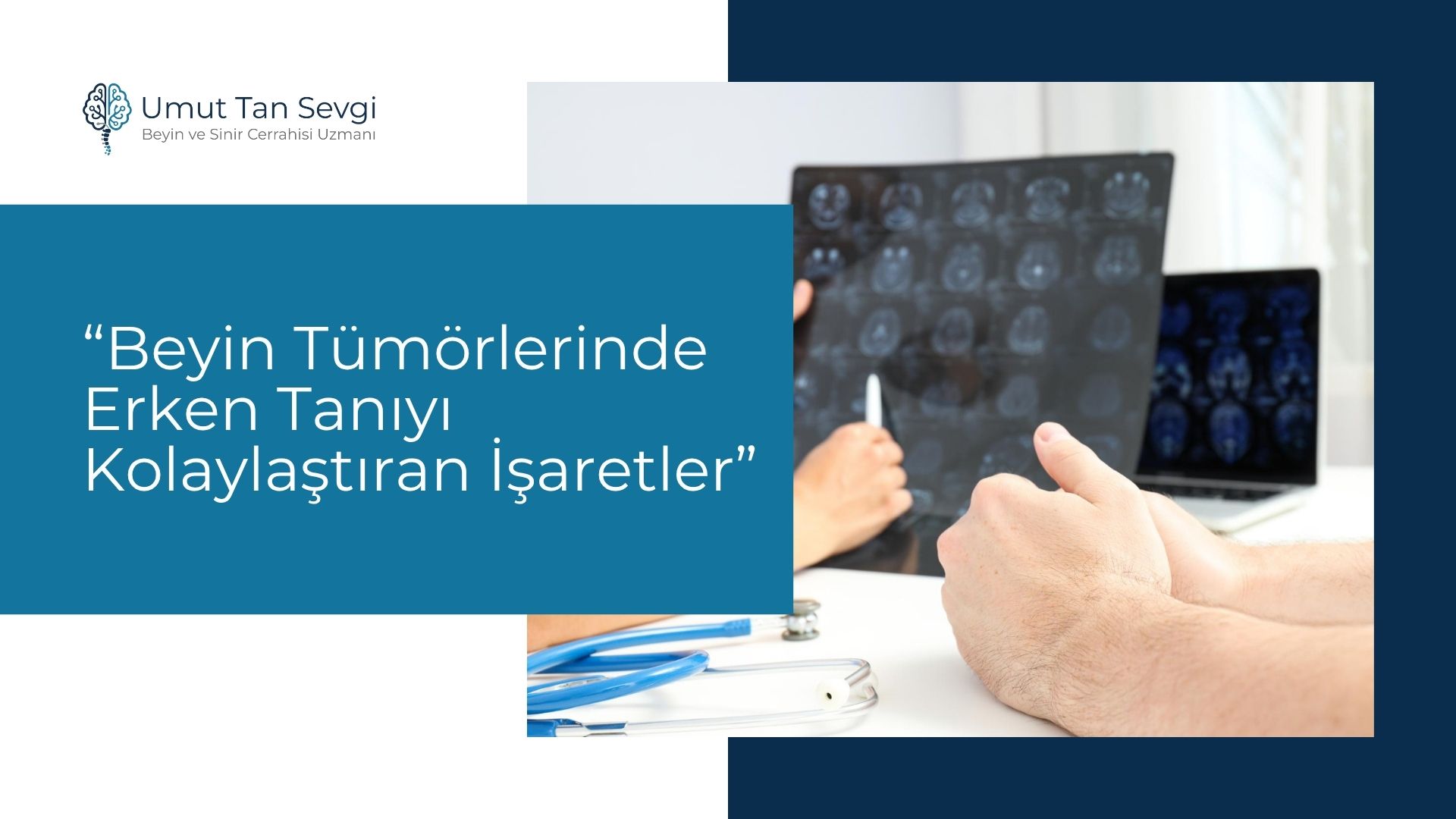 Beyin Tümörlerinde Erken Tanıyı Kolaylaştıran İşaretler