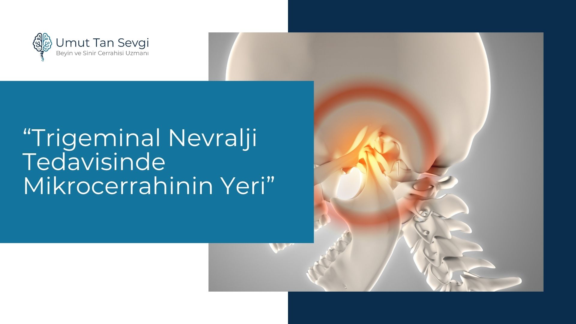Trigeminal Nevralji Tedavisinde Mikrocerrahinin Yeri